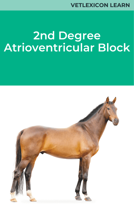 2nd Degree Atrioventricular Block