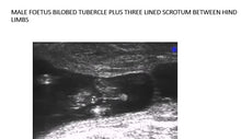 Male Foetus Bilobed Turbercle plus Three Lined Scrotum Between Hind Limbs